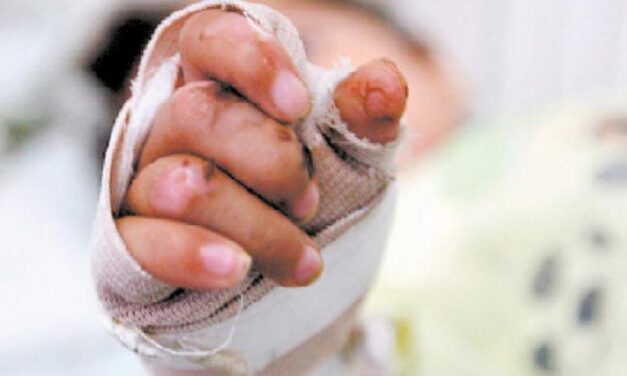 Antioquia se convierte en el departamento con más quemados por pólvora