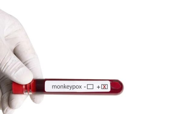 Se confirman los primeros casos de viruela símica en tres municipios del Oriente