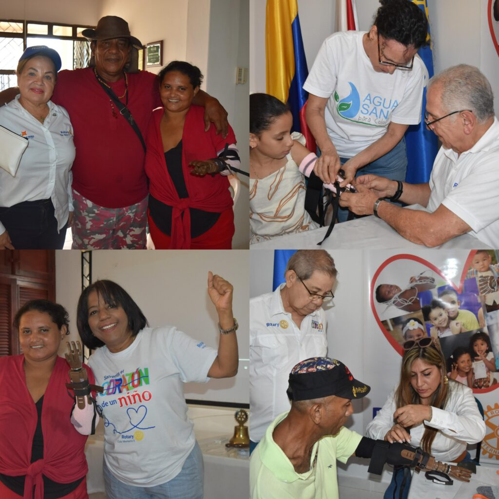 TE DAMOS UNA MANO: Poder transformador de las prótesis del Club Rotario Montería 2 WhatsApp Image 2025 05 13 at 2.33.29 PM